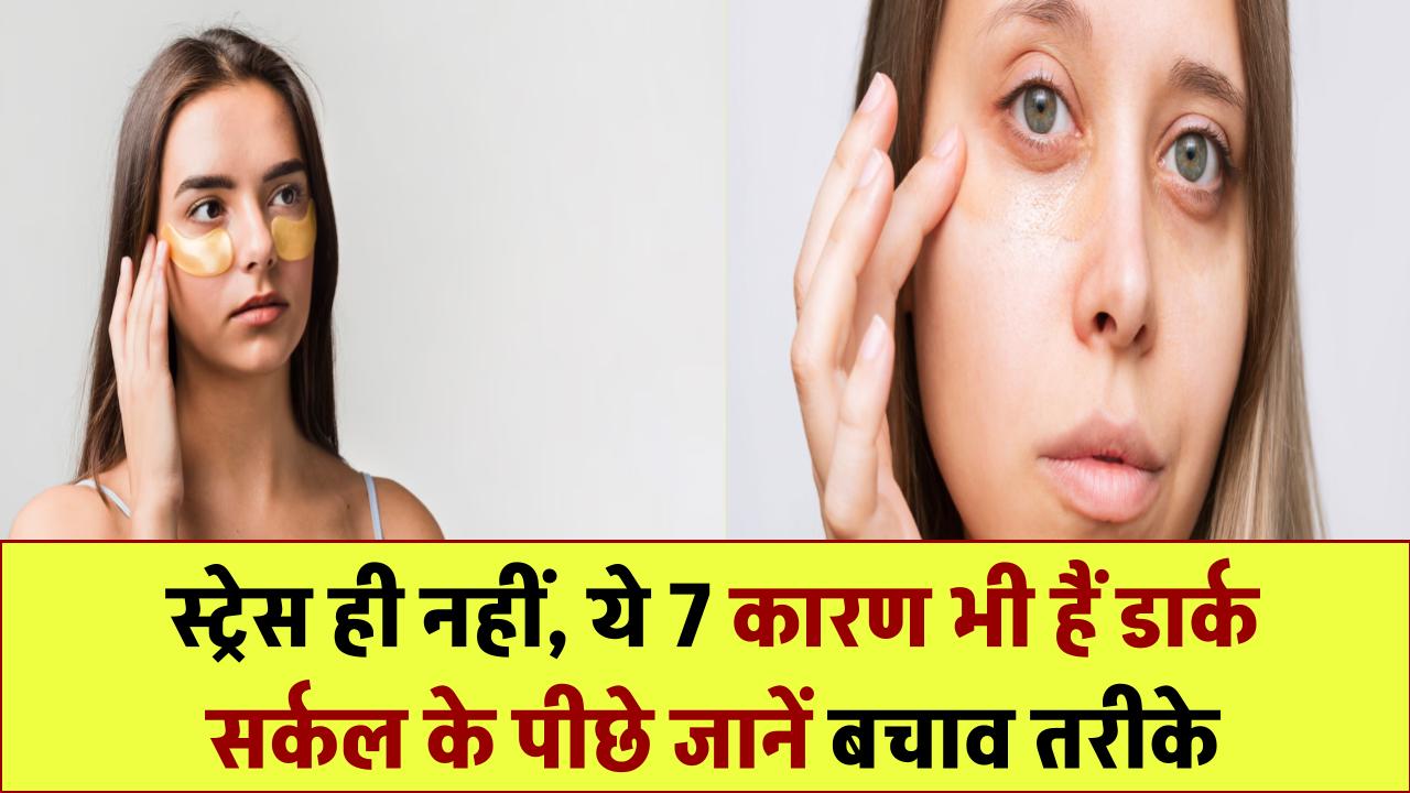 सिर्फ स्ट्रेस ही नहीं! आंखों के नीचे काले घेरे होने के ये 7 और कारण भी जानें, बचने के आसान उपाय भी शामिल