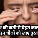 b12 की कमी से चेहरा हो सकता है काला, इन चीजों को खाना शुरू करें आज से ही