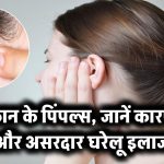 कान पर निकलते हैं दर्दनाक पिंपल्स? जानिए इसकी वजह और 100% असरदार घरेलू इलाज