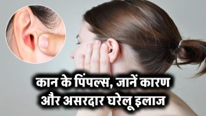 कान पर निकलते हैं दर्दनाक पिंपल्स? जानिए इसकी वजह और 100% असरदार घरेलू इलाज