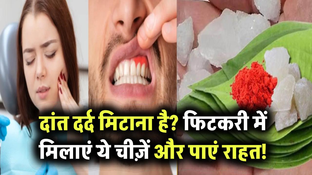 दांत दर्द गायब करना है तो आज़माएं ये घरेलू नुस्खा! फिटकरी में मिलाएं ये चीज़ें और देखें कमाल