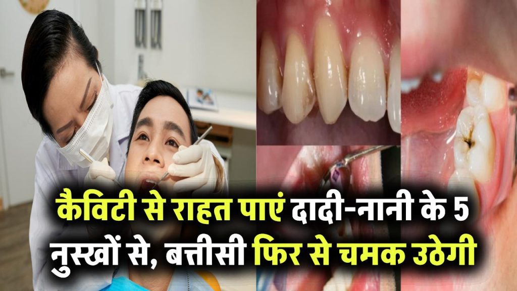 दांतों में कैविटी से हैं परेशान? दादी-नानी के ये 5 घरेलू नुस्खे देंगे राहत और बत्तीसी होगी चमकदार