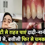 दांतों में कैविटी से हैं परेशान? दादी-नानी के ये 5 घरेलू नुस्खे देंगे राहत और बत्तीसी होगी चमकदार