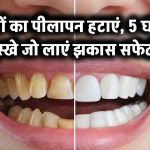 दांत पर छा गया पीलापन? ये 5 घरेलू नुस्खे आजमाएं, कुछ ही दिनों में दिखेगा झकास सफेदी का कमाल