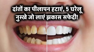 दांत पर छा गया पीलापन? ये 5 घरेलू नुस्खे आजमाएं, कुछ ही दिनों में दिखेगा झकास सफेदी का कमाल
