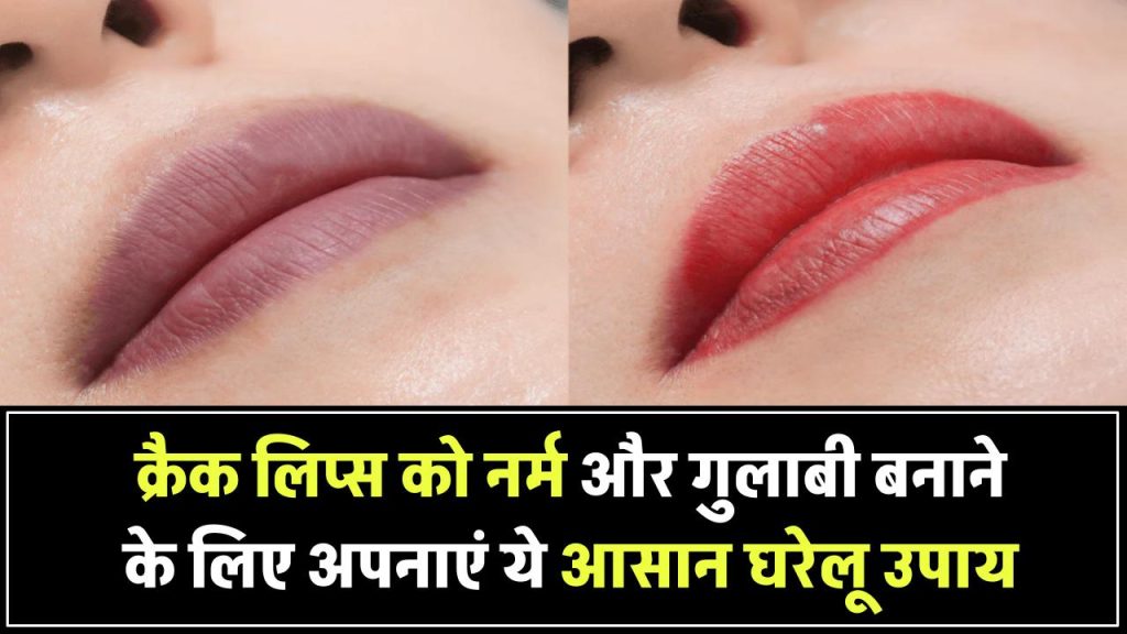 लिप्स एक्सफोलिएशन के लिए ये आसान घरेलू उपाय अपनाएं, क्रैक लिप्स बनेंगे नर्म और गुलाबी