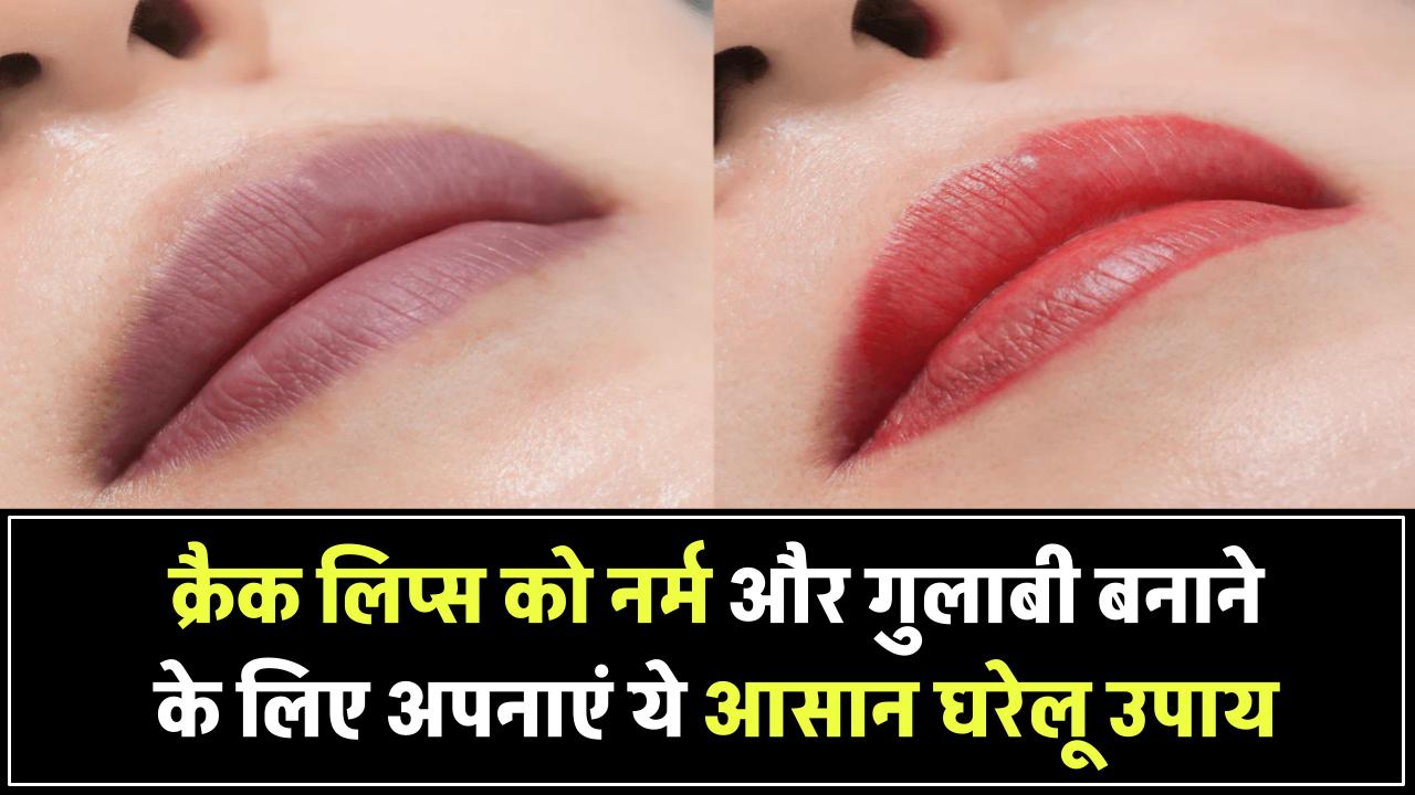 लिप्स एक्सफोलिएशन के लिए ये आसान घरेलू उपाय अपनाएं, क्रैक लिप्स बनेंगे नर्म और गुलाबी