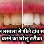 Teeth Cleaning Tips: पान मसाला से पीले हुए दांत घर पर कैसे साफ करें? जानिए आसान घरेलू तरीका