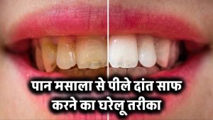 Teeth Cleaning Tips: पान मसाला से पीले हुए दांत घर पर कैसे साफ करें? जानिए आसान घरेलू तरीका
