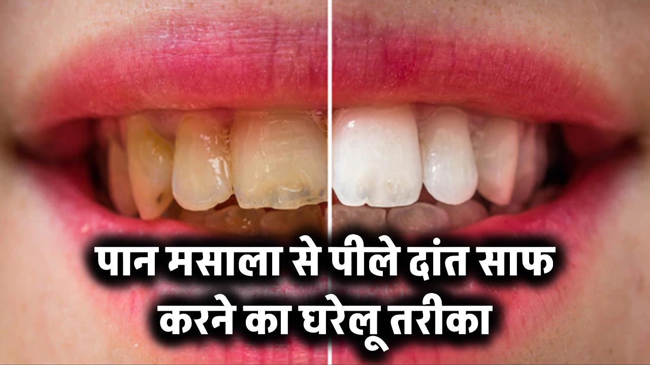 Teeth Cleaning Tips: पान मसाला से पीले हुए दांत घर पर कैसे साफ करें? जानिए आसान घरेलू तरीका