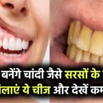 दांत बनेंगे चांदी जैसे चमकदार! सरसों के तेल में मिलाकर लगाएं ये एक चीज, फर्क देख हैरान रह जाएंगे