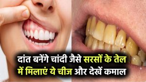 दांत बनेंगे चांदी जैसे चमकदार! सरसों के तेल में मिलाकर लगाएं ये एक चीज, फर्क देख हैरान रह जाएंगे