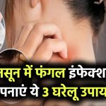 मानसून में फंगल इंफेक्शन? अपनाएं ये 3 आसान घरेलू उपाय, जलन और खुजली से मिलेगा आराम