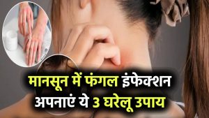 मानसून में फंगल इंफेक्शन? अपनाएं ये 3 आसान घरेलू उपाय, जलन और खुजली से मिलेगा आराम